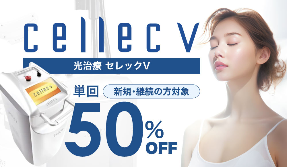 セレックキャンペーン