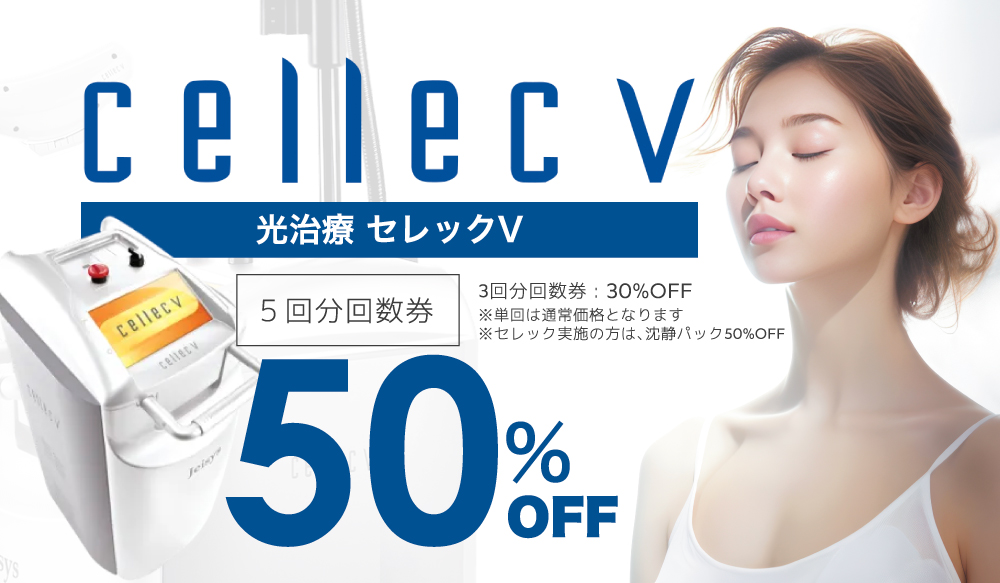 セレックキャンペーン